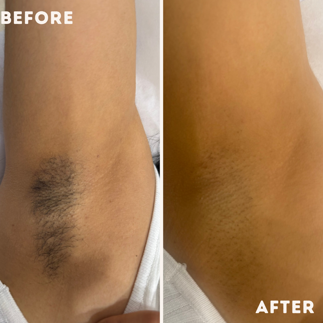 Aesthetics treatment result